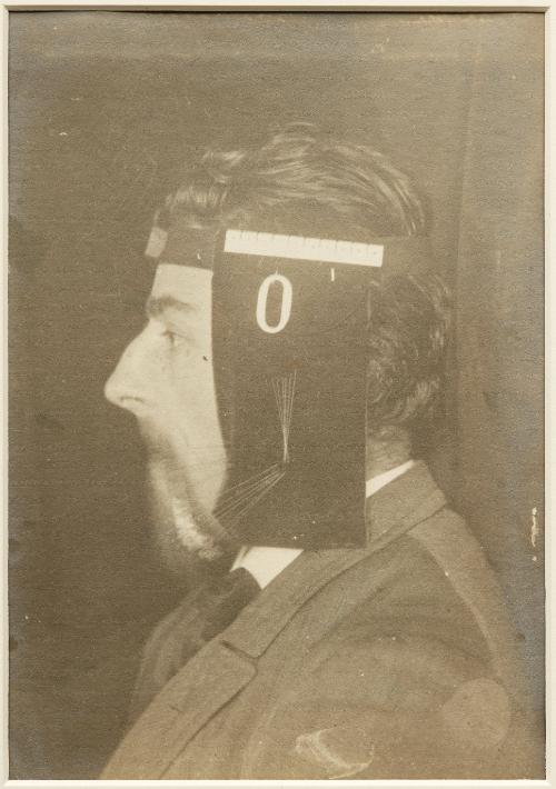 Chronophotographic study of the movements of the jaw