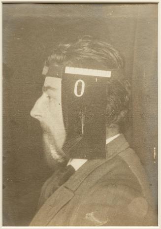 Chronophotographic study of the movements of the jaw