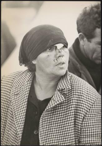 A woman with injuries to her face in the aftermath of the Belice earthquake, Sicily 1968