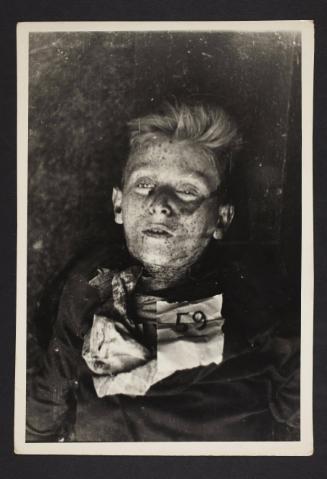 A young ghetto victim in the morgue