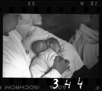 Nurse holding baby before surgery
